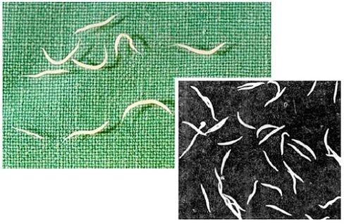 Pinworms dari badan manusia