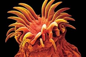 Parasit trematod pada manusia