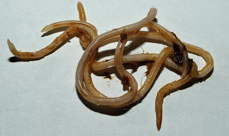 Toxocara dari tubuh manusia